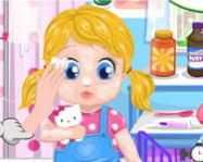 Barbies baby allergy online